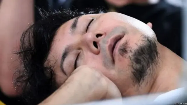 શું છે નિદ્રા સાથે સંકળાયેલી બીમારીનાં લક્ષણો?