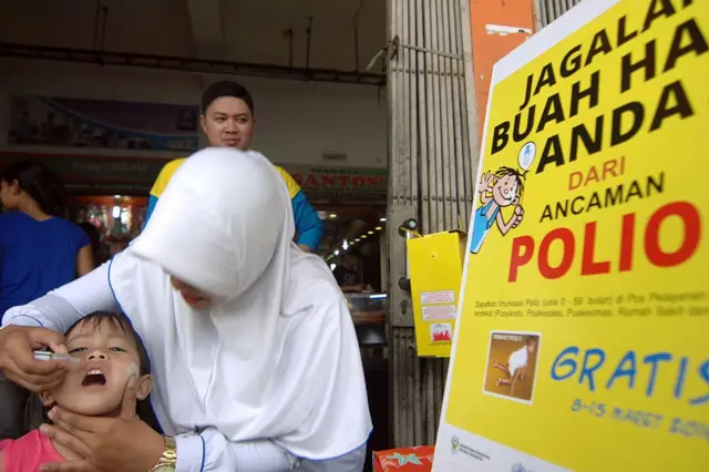 Seorang anak menerima vaksin polio.