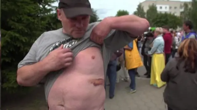 یکی از بازداشت شدگان آزاد شده، زخم های خود را نشان میدهد