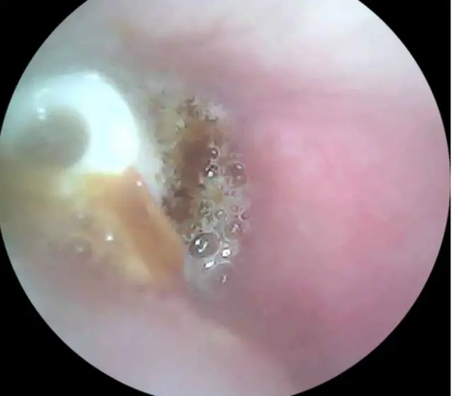 Yassi kokrakli ayollar blowjobs beradi Erotik eng yaxshi kitoblar