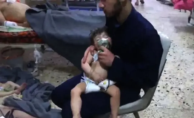 یک امدادرسان در حال نگه داشتن گاز اکسیژن برای کودکی است که گفته می‌شود در حمله دوما مسموم شد