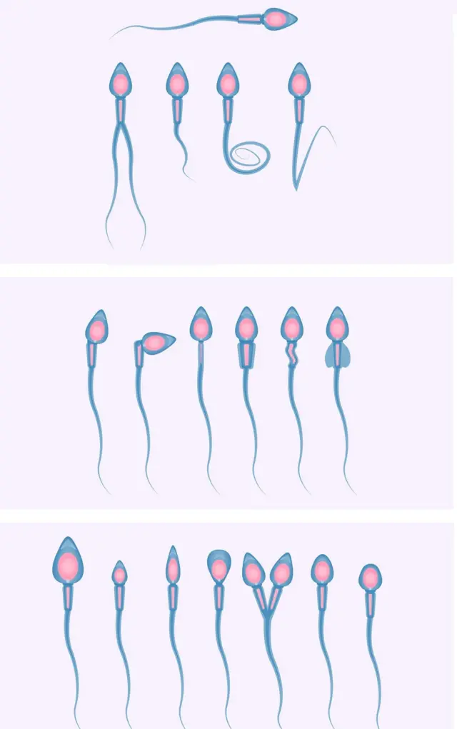 sperm
