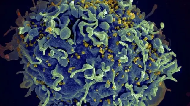 انفیکشن، سیکس