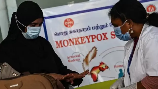 குரங்கம்மை பாதிப்பு