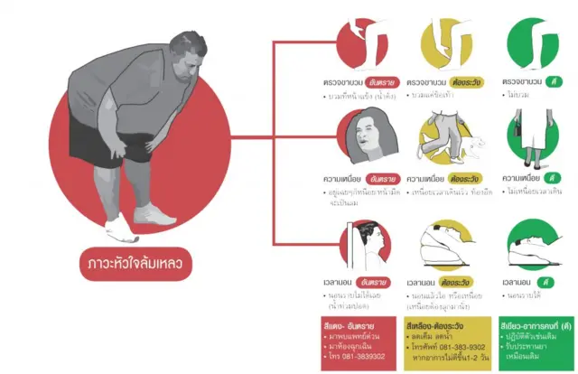 ภาวะหัวใจล้มเหลว
