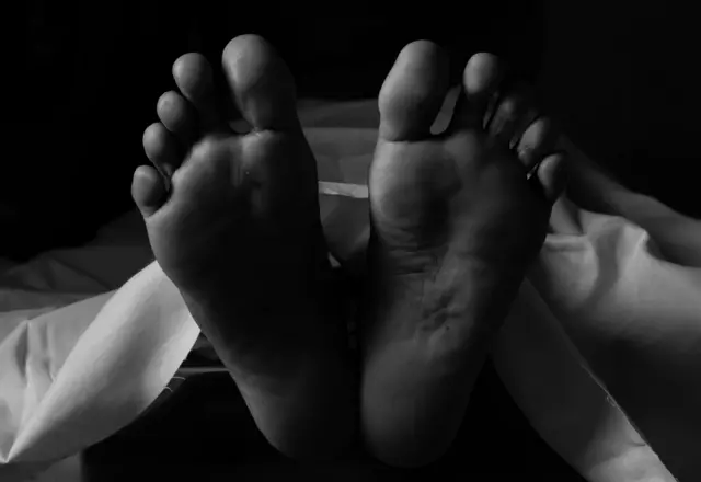 Foto hitam putih kaki jenazah.
