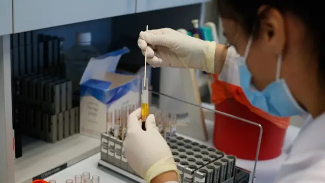 একটি ল্যাবে চলছে এ্যান্টিবডি টেস্ট