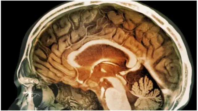 انسانی دماغ