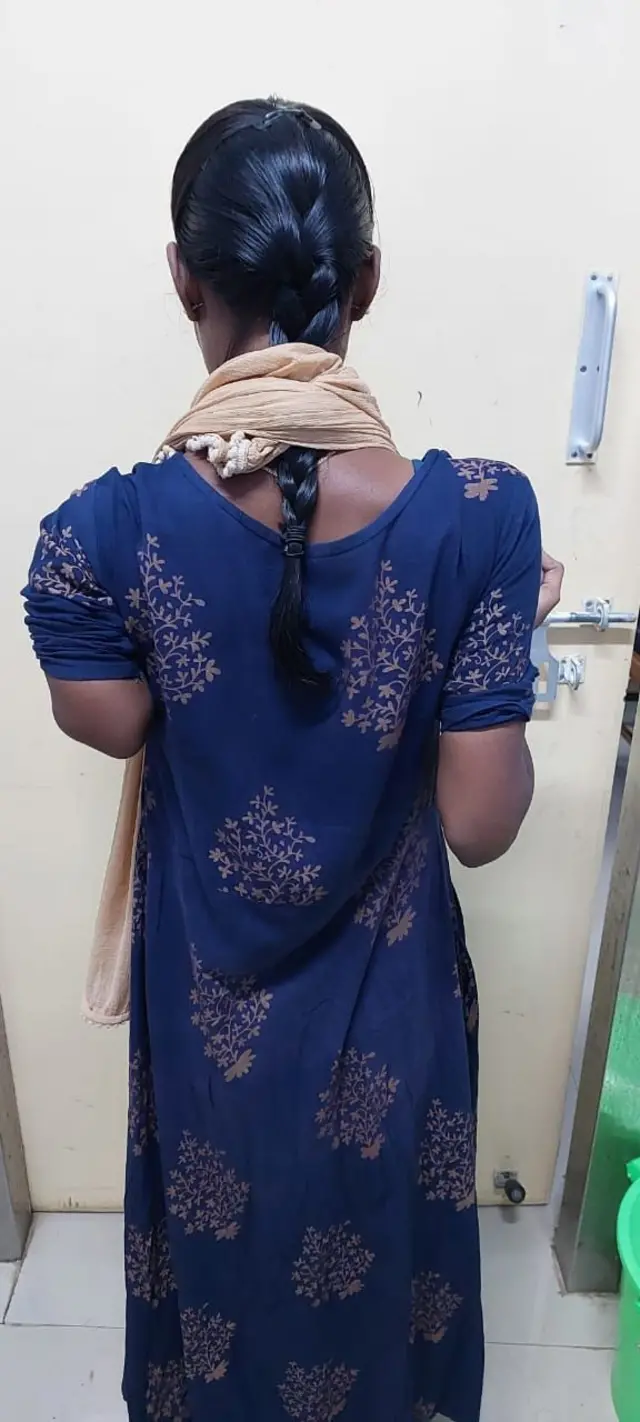 பெண்ணுக்கு 14 செ.மீ. எலும்பை வளரவைத்து அரசு மருத்துவர்கள் சாதனை