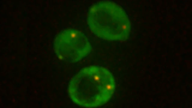 'இந்தப் பூஞ்சை செவ்வாய் கோளில்கூட சாகாது' - விஞ்ஞானிகளை வியக்க வைத்த கண்டுபிடிப்பு