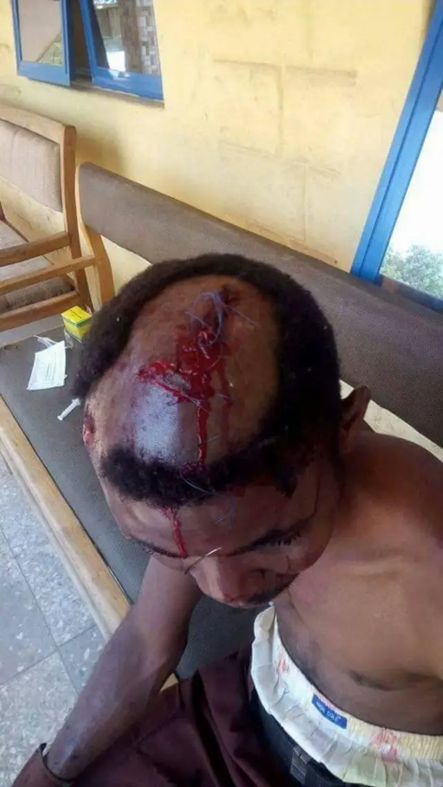 Man wound for head
