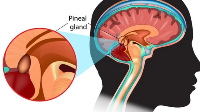 Glândula pineal