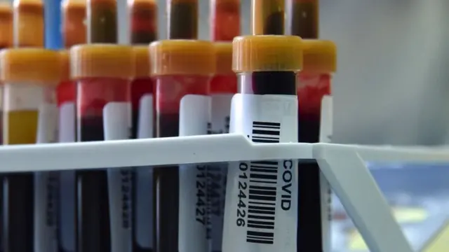 Vials of blood for Covid testing