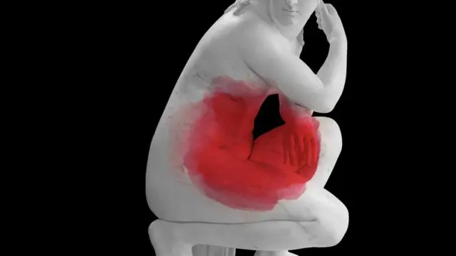 Ендометріоз