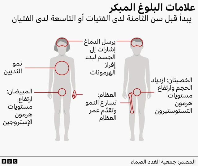 جرافيك يوضّح علامات البلوغ المبكر لدى الأطفال على رسم توضيحي لجسدي فتى وفتاة