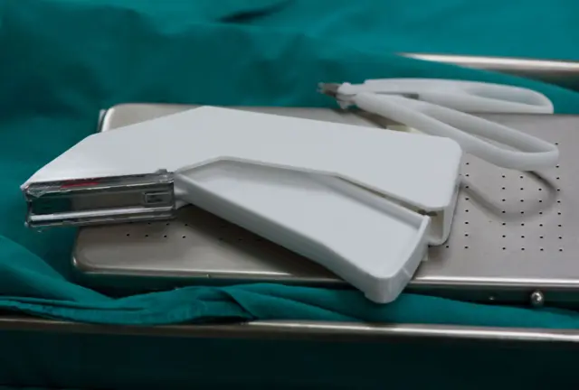 உடல்நலம், மருத்துவம், அறுவை சிகிச்சை, ஸ்டேபிளர் பின், கோவை 
