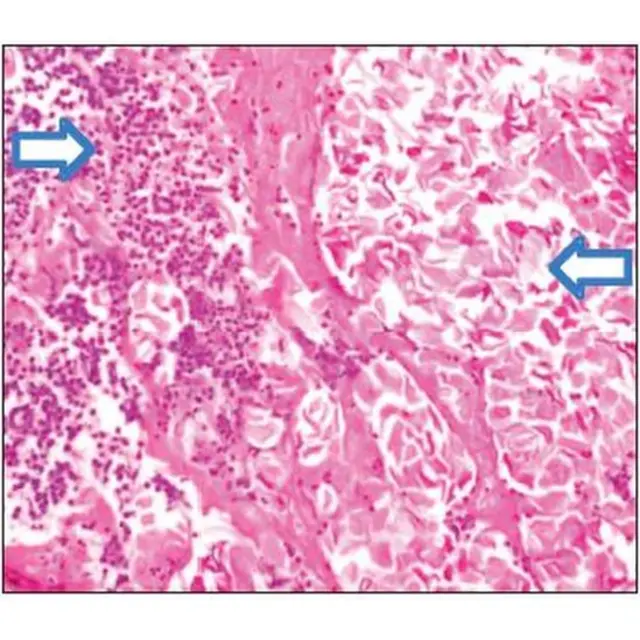 Pavez V, Marcelo, Villanueva F, Manuel, Middleton I, Felipe, Cevo E, Jimena, & Papuzinski A, Cristian. (2016). Münchausen syndrome by proxy in otorhinolaryngology Magazine of Otorhinolaryngology and head and neck surgery, 76(2), 231-235.