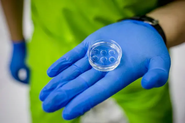 आईवीएफ़