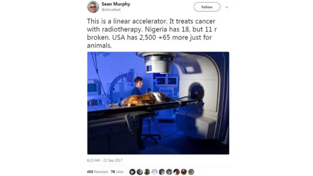 Di man say na only 6 out of di radiotherapy machine wey dem dey use treat cancer dey work for Nigeria when dem get pass 2000 of those machine for US.