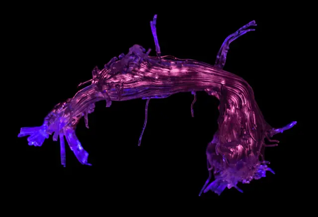 Language pathways of the brain