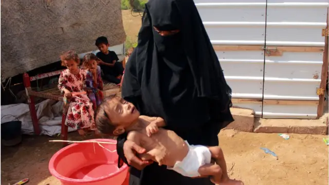 اليمن