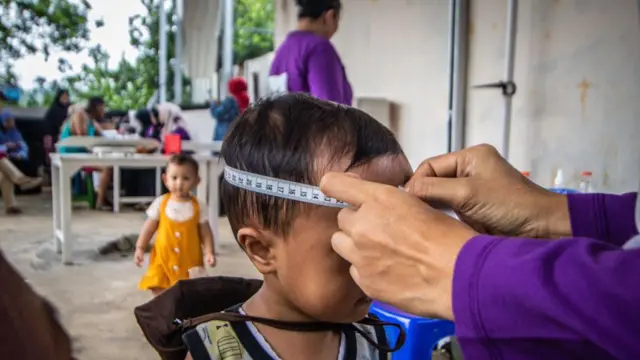 इंडोनेशिया में बच्चों में कुपोषण 