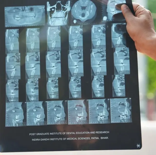 બીબીસી ગુજરાતી, ગુજરાત, બીબીસી, બિહાર, મેડિકલ