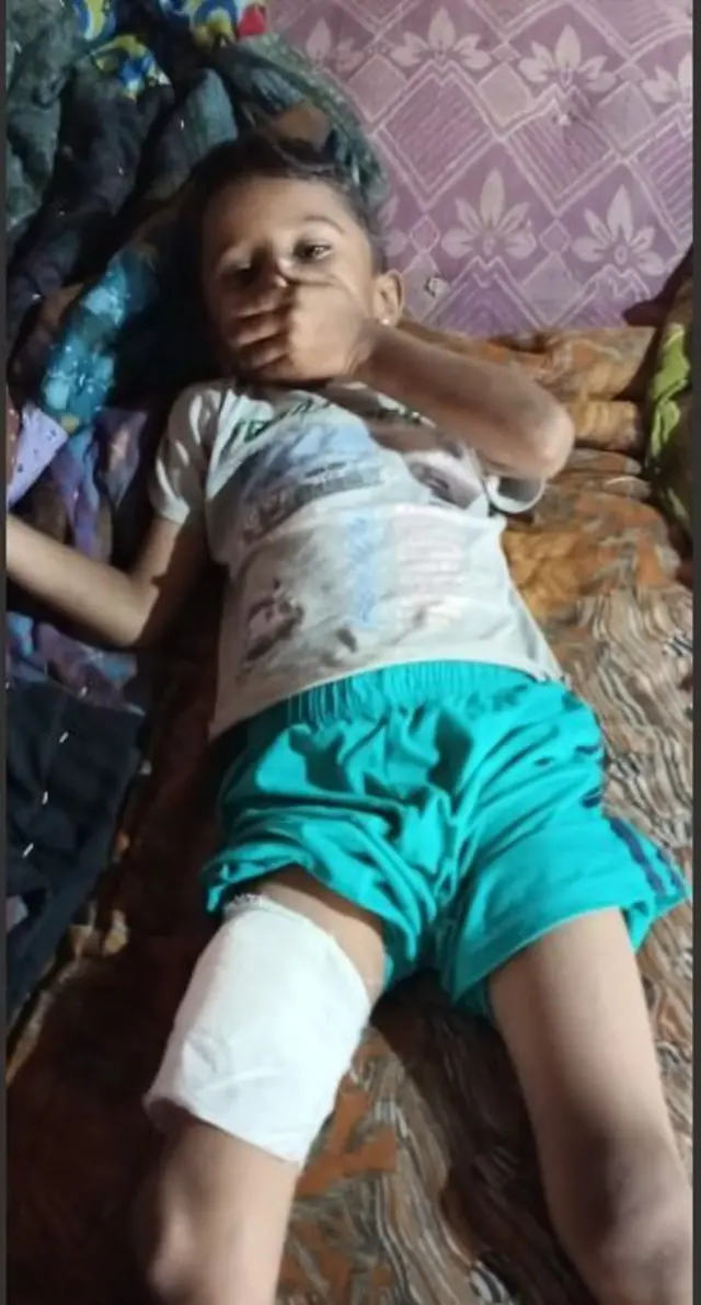 દહેગામ વાંદરાઓનો આતંક