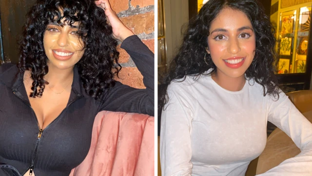 Ranvia before and after surgery
