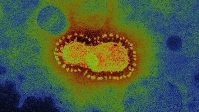 করোনাভাইরাস