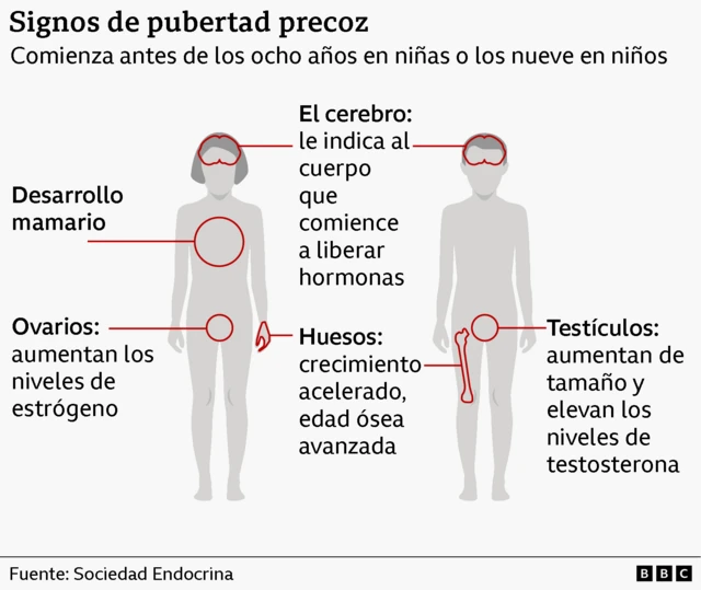 Una ilustración gráfica de un cuerpo masculino y uno femenino señala los signos de pubertad precoz en los niños.