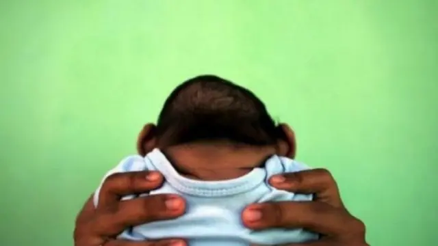 குறைபாடுகளுடன் குழந்தைகள் பிறக்க காரணமான ஜிகா வைரஸ் தொற்று