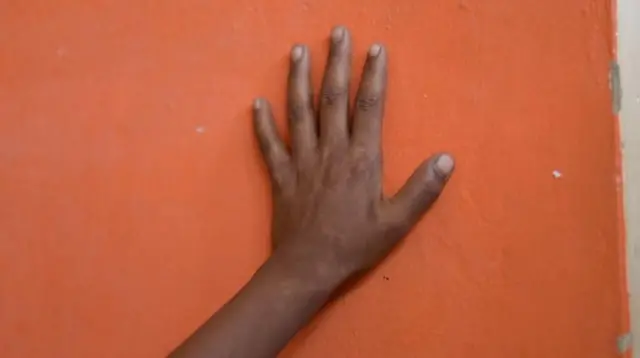 આ કેસનાં બધા જ પીડિતો ડિપ્રેશનમાં છે અને તેમના પરિવારનાં લોકો તેમનું ધ્યાન રાખી રહ્યાં છે