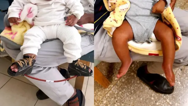 የጫማ ህክምና