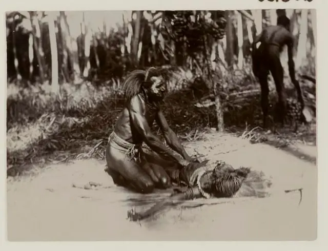 Foto lawas Orang Papua. Seorang dukung sedang merawat orang sakit.