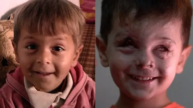 Sura ya mtoto aliyeshambuliwa na kabla ya shambulizi