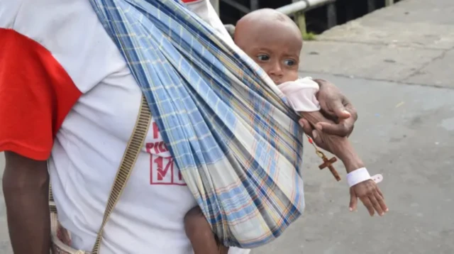 Asmat, gizi buruk, Papua 