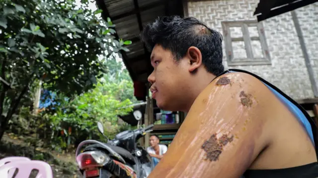 ကိုရန်မျိုးအောင်ဟာ ဝှေခါကျောက်တွင်းမြေပြိုမှုမှာ အသက်ရှင် လွတ်မြောက်ခဲ့သူတွေထဲက တစ်ဦးဖြစ်ပါတယ်