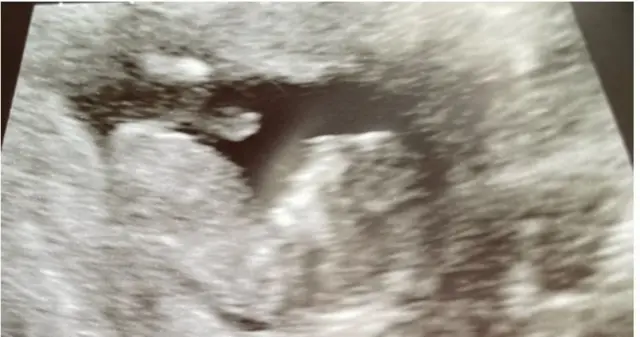 Vyitezwe ko umwana wa Berth na Shaun wa gatatu avuka mu kwezi kw'indwi