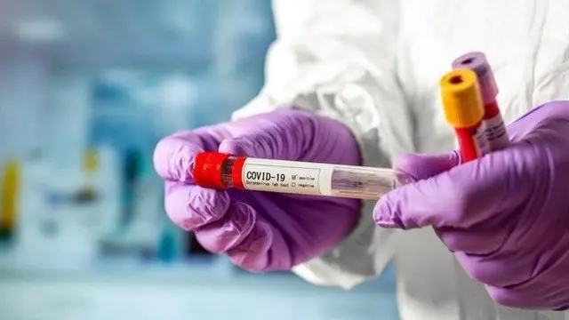 Тест текшириш