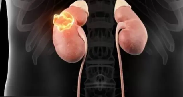 Akịrị ahụ mmadụ