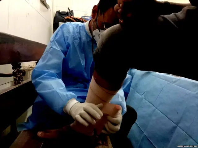 कामरान को पैरों और हाथों पर चोटें आई हैं.