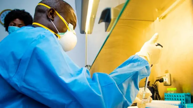 Aworan ayẹwo fun Covid-19