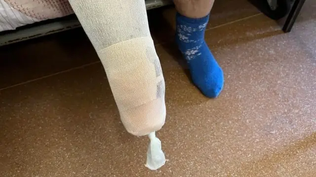 Противопехотные мины как правило не убивают, но калечат людей