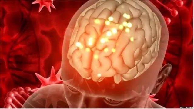 इंसान का दिमाग