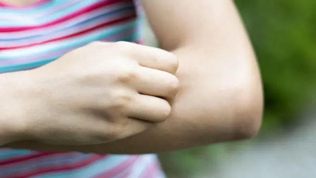 வெஸ்ட் நைல் வைரஸ் தொற்று