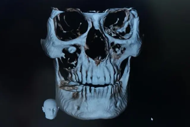 બીબીસી ગુજરાતી, ગુજરાત, બીબીસી, બિહાર, મેડિકલ