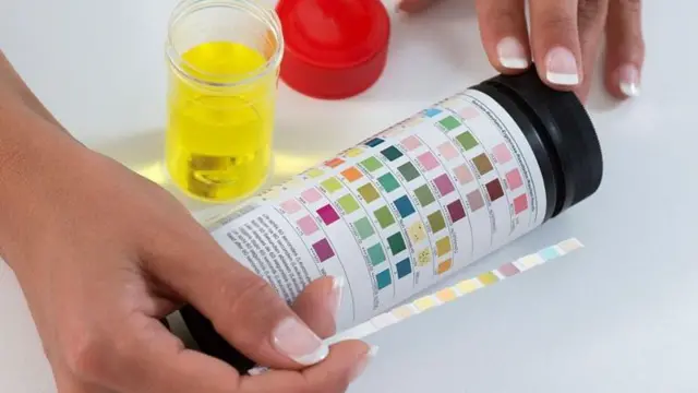 యూటీఐ సమస్య