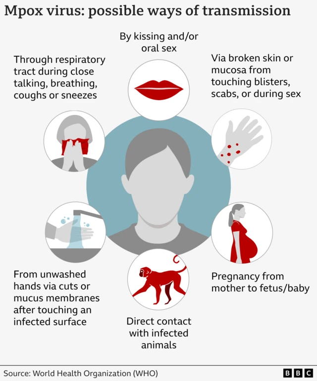 Graphic describing mpox transmission