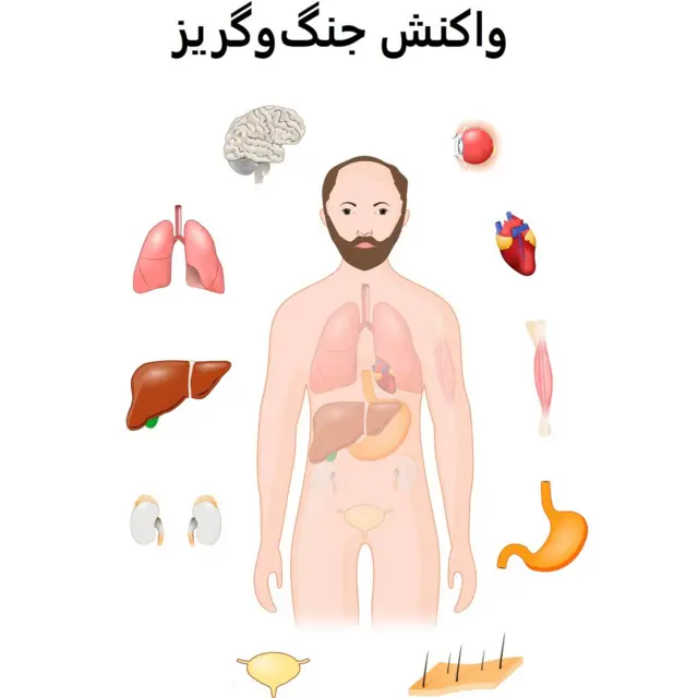 واکنش جنگوگریز